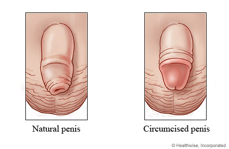 Un Circumsised Penis 3