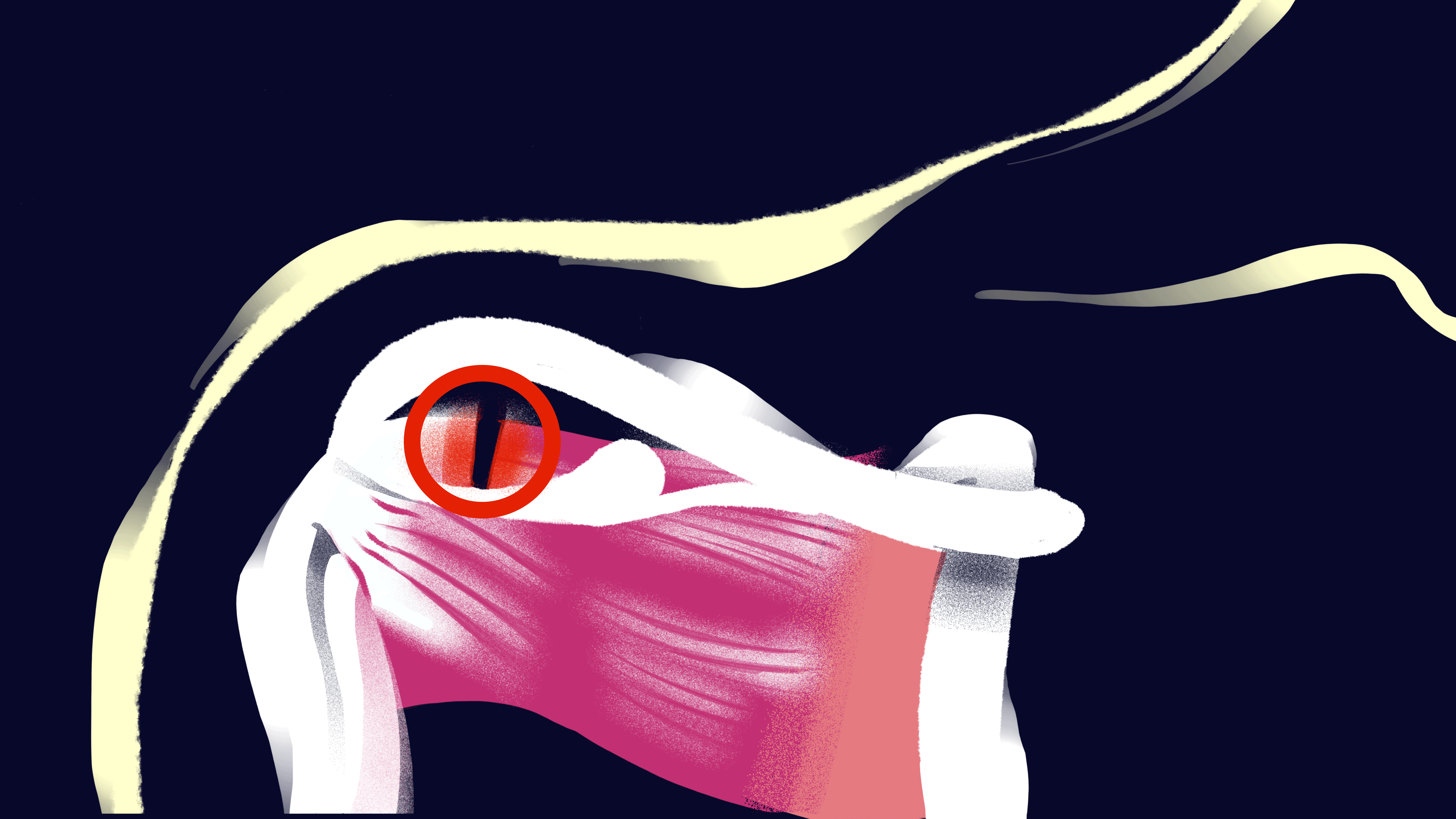 red spot in shoulder pulsing red with circle around it on black background and see-through to shoulder bone and joint