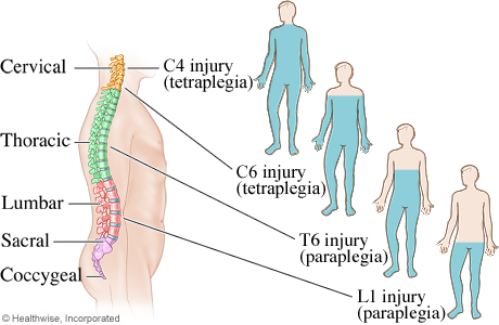 Areas of the body affected by spinal cord injuries