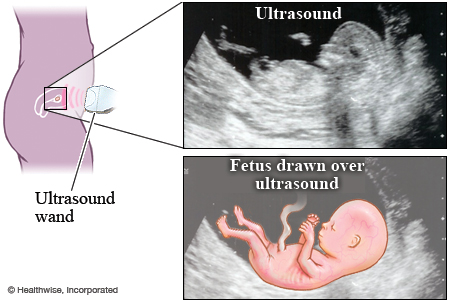 Image and picture of fetal ultrasound