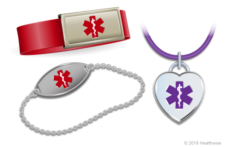 Three examples of medical alert bracelets