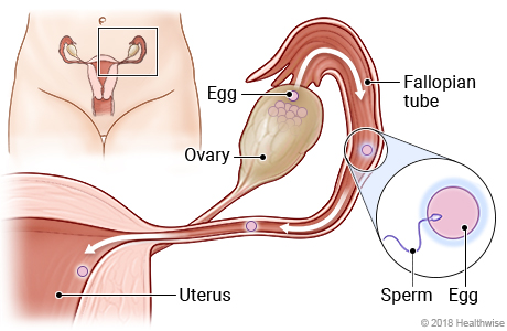Female reproductive system, with detail of egg passing from ovary to fallopian tube where it is fertilized by sperm