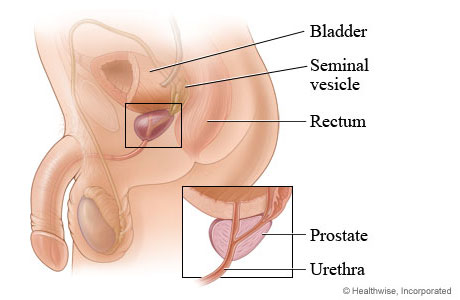 Prostate gland and its location in the body
