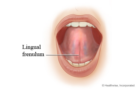 Lingual frenulum