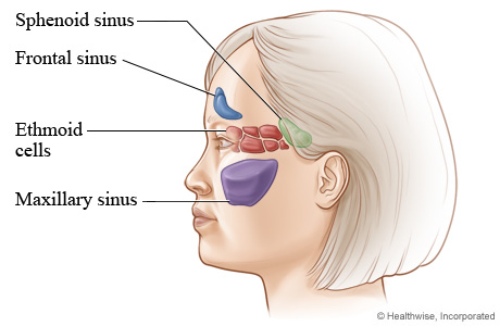 Where nasal sinus cavities are located (side view)