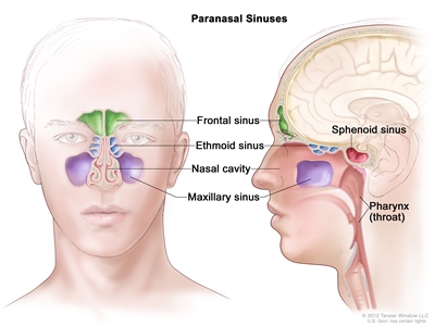 Anatomy of the paranasal sinuses; drawing shows front and side views of the frontal sinus, ethmoid sinus, maxillary sinus, and sphenoid sinus. The nasal cavity and pharynx (throat) are also shown.
