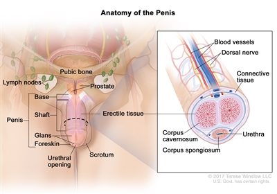 Anatomy of the penis; drawing shows the base, shaft, glans, foreskin, and urethral opening. Also shown are the scrotum, prostate, pubic bone, and lymph nodes. An inset shows a cross section of the inside of the penis, including the blood vessels, dorsal nerve, connective tissue, erectile tissue (corpus cavernosum and corpus spongiosum), and urethra.