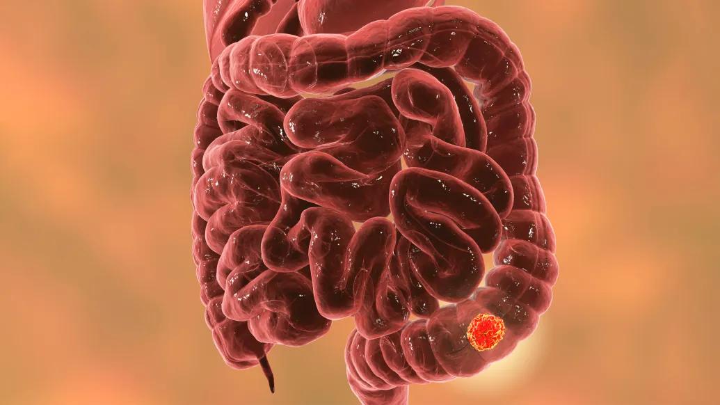intestines red with red dot 