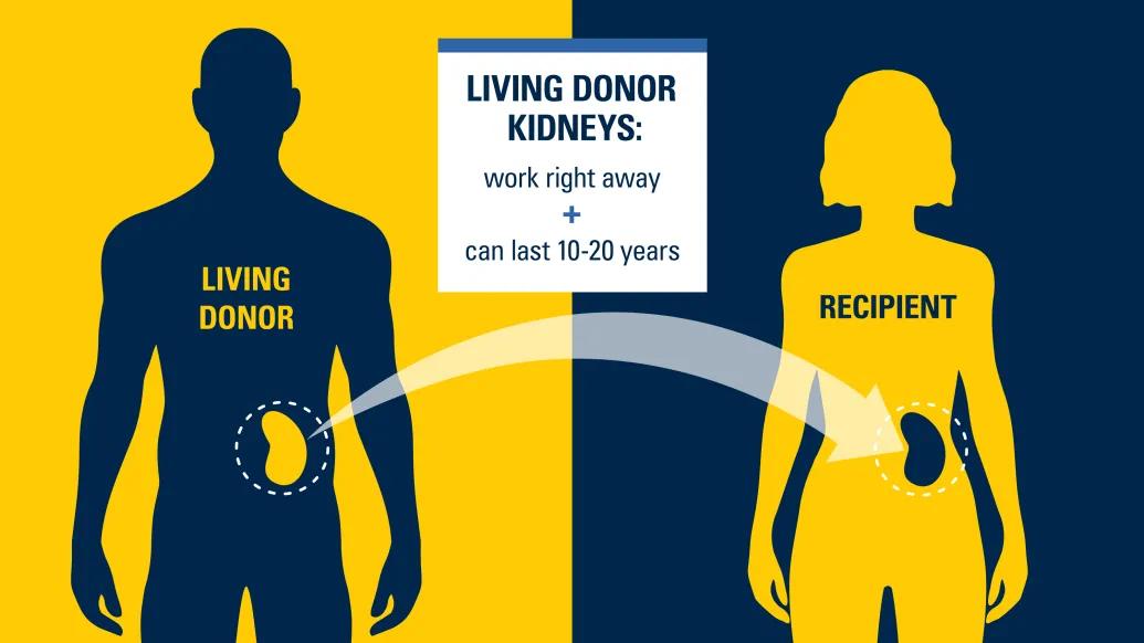 living donor kidneys two people in blue and yellow colors silhouette swapping kidneys 