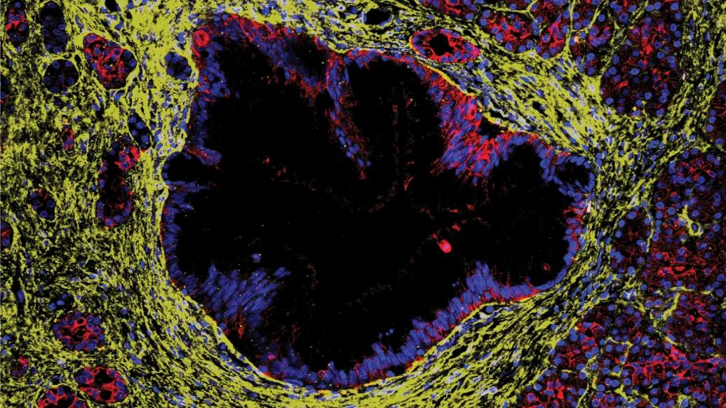 yellow black purple red cell in middle mostly black