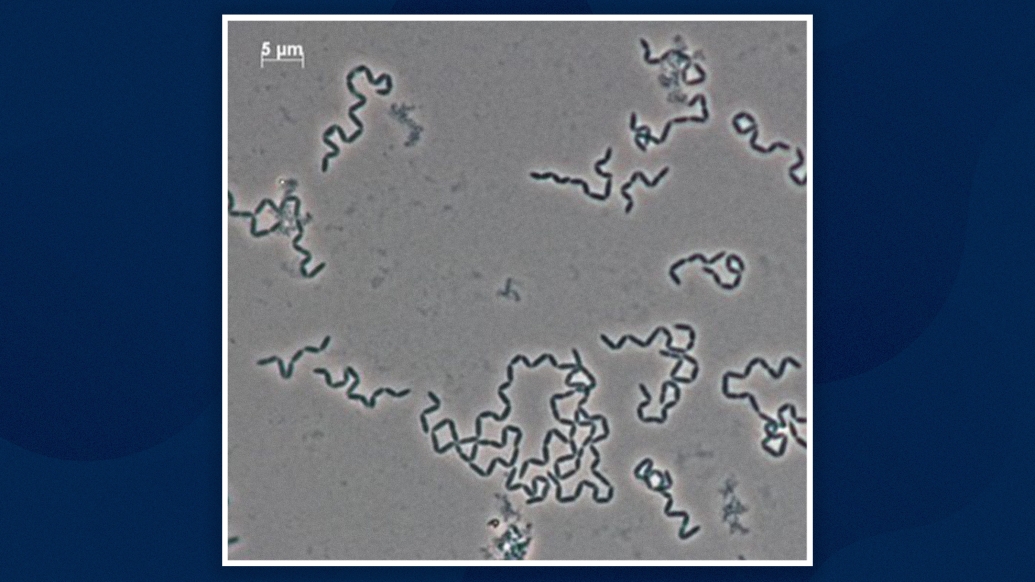close up of cells moving in blue lines grey background under microscope
