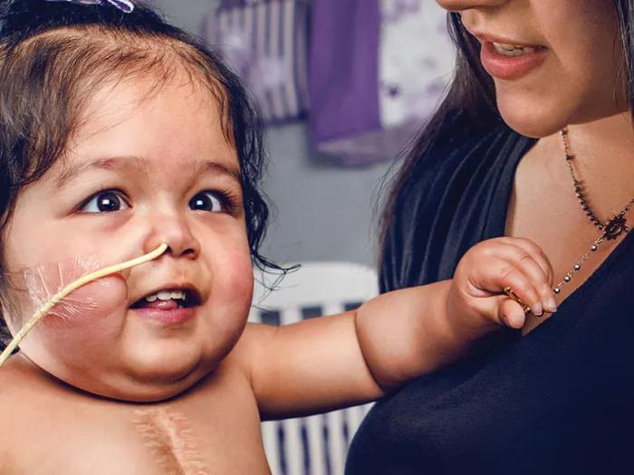 Baby Amaris, who has a tube in her nose, smiles with mother at her side