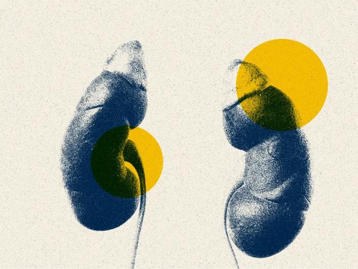 kidneys blue yellow