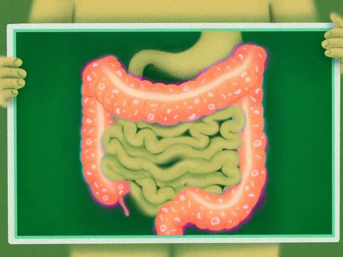 green background intestines in pink