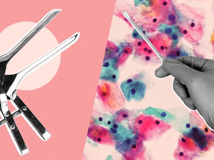 Speculum illustration including a gloved hand holding a swab in front of microscopic cells