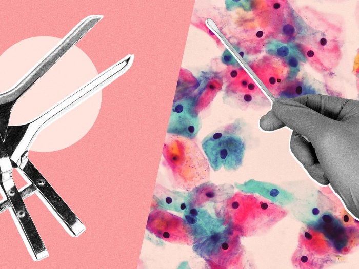 Speculum illustration including a gloved hand holding a swab in front of microscopic cells