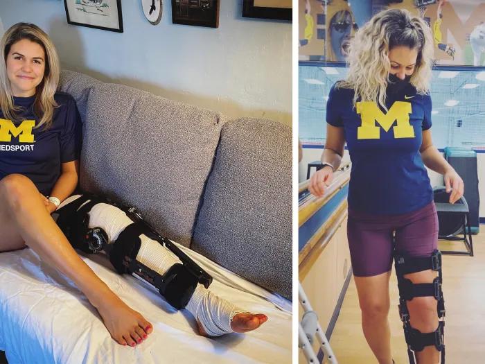 girl sitting on couch with brace on and standing with brace on in UM shirts