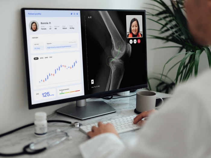 screen of chart and xray and patient and doctor white coat vague in background at computer sitting at keyboard