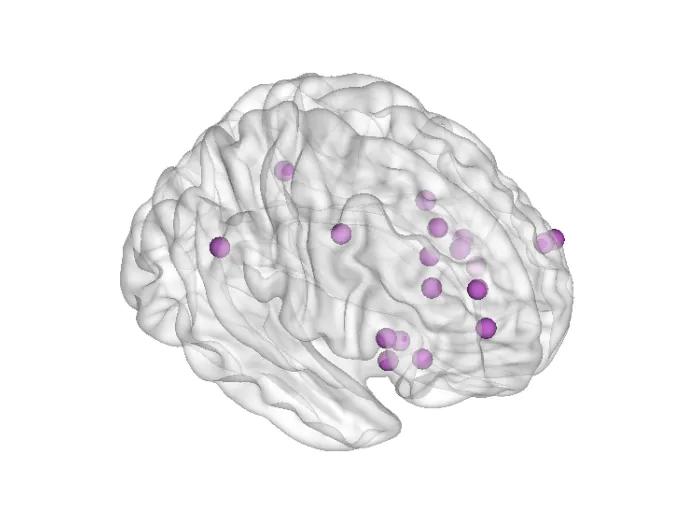 grey brain with purple dots