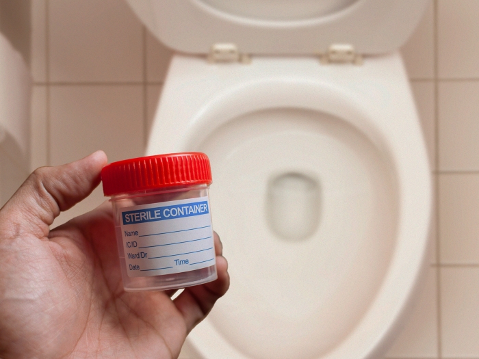 cup sample with orange top in front of toilet