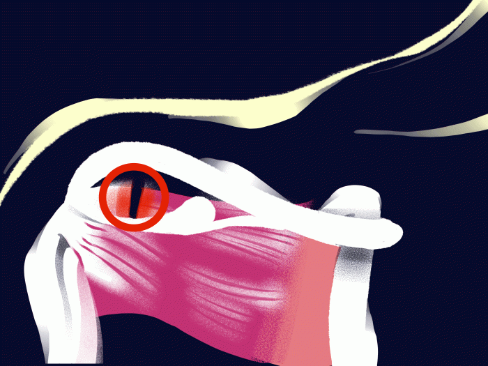 red spot in shoulder pulsing red with circle around it on black background and see-through to shoulder bone and joint