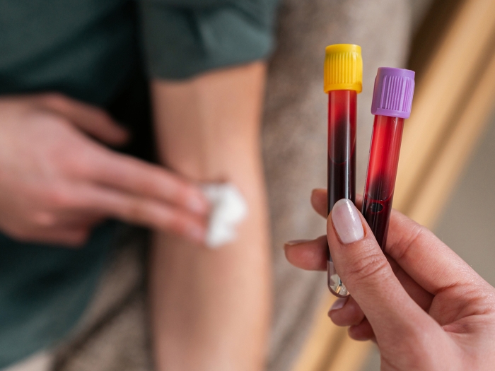 blood test bottles above arm with white bandaid
