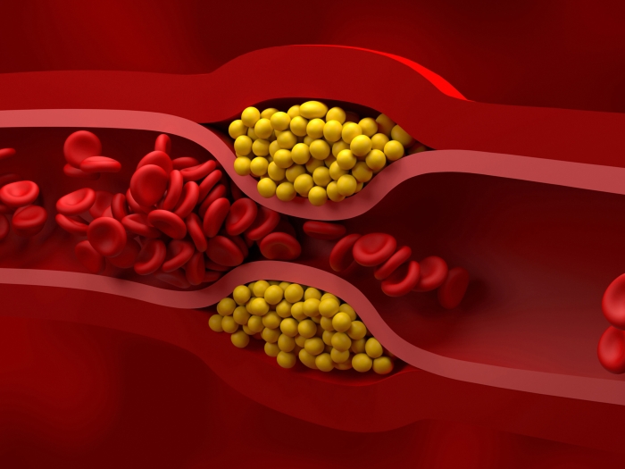 blood vessel up close with red cells and yellow inside
