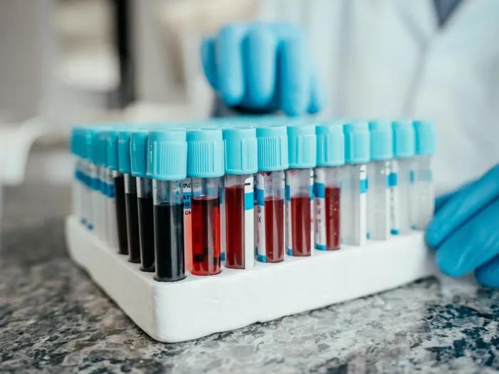 blood vials together with blue caps and blue gloves 