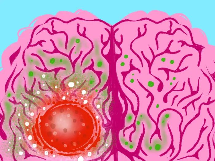 light blue background with pink brain with red circle area growing