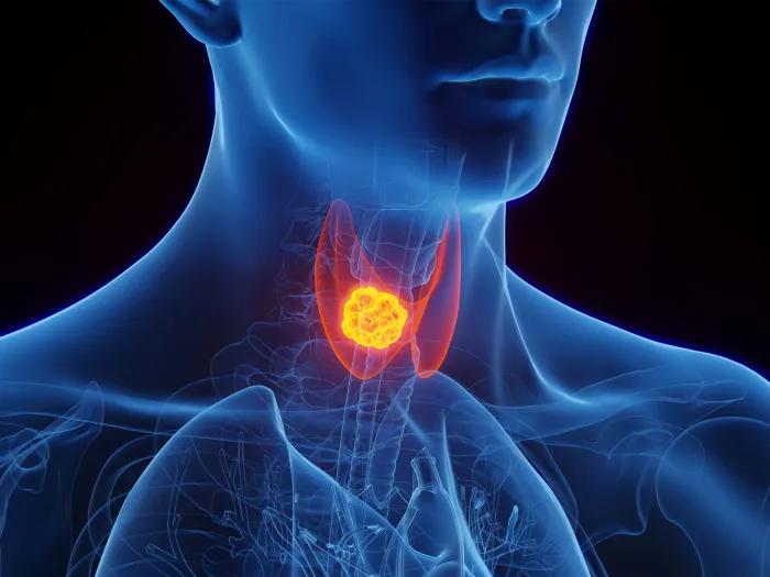 graphic of inside of a person's throat lit up orange and red 