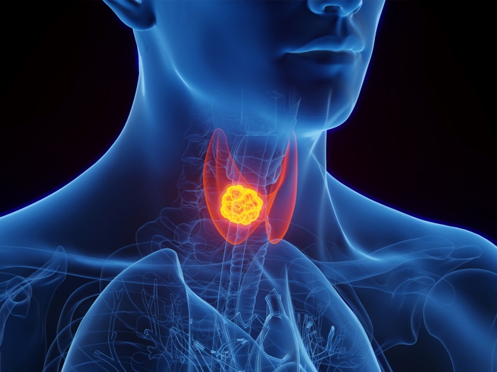 graphic of inside of a person's throat lit up orange and red 