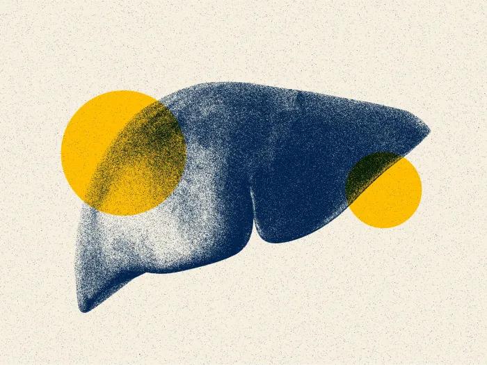 liver image with two yellow spots floating artistically 