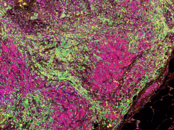 green pink close up on microscope