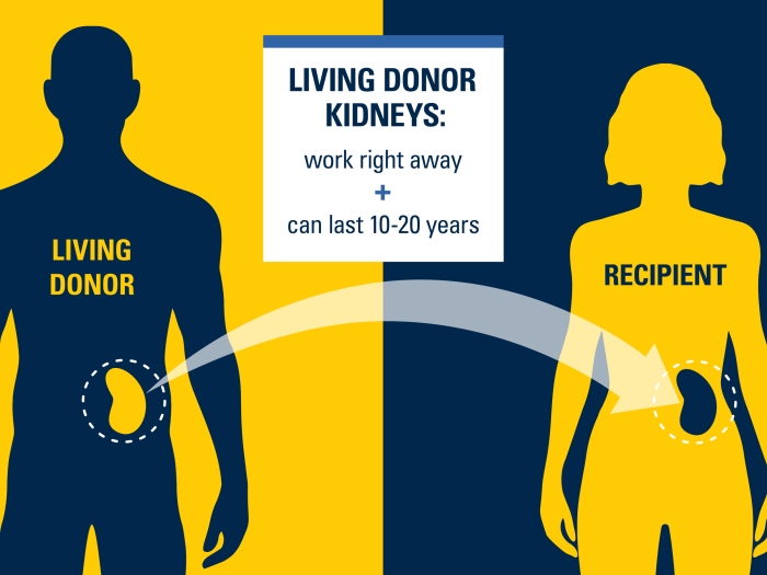 living donor kidneys two people in blue and yellow colors silhouette swapping kidneys 