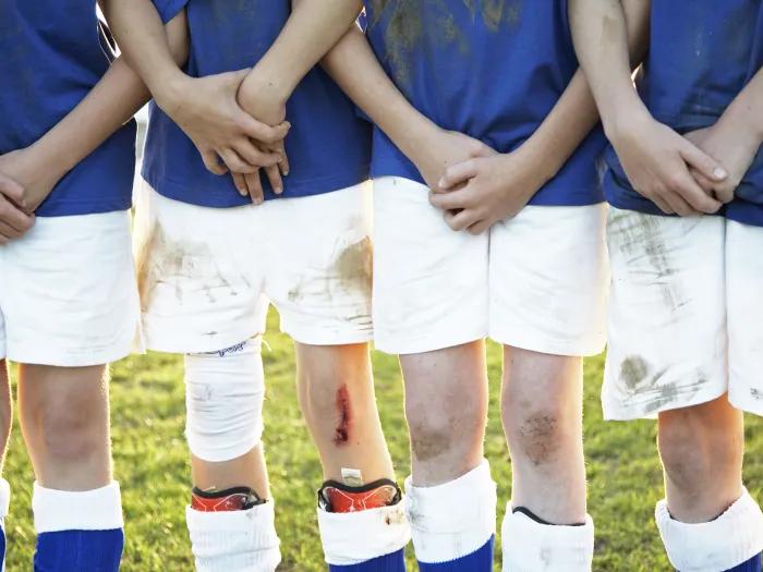 Row of kids with skinned knees shown from elbows down wearing blue shirts and dirty white shorts