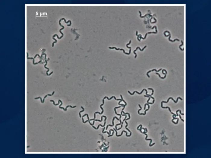 close up of cells moving in blue lines grey background under microscope