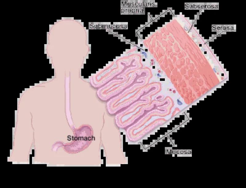 Gastric Layers Stomach Cancer