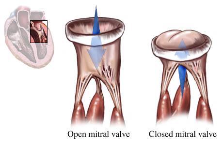 Illustration showing normal mitral valve open and closed
