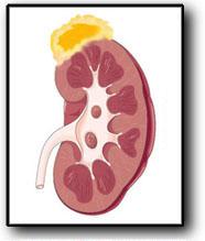 Illustration of yellow adrenal gland on top of kidney