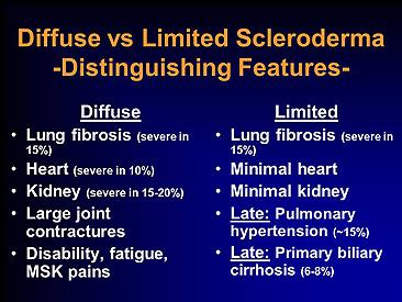Diffuse vs Limited scleroderma Image
