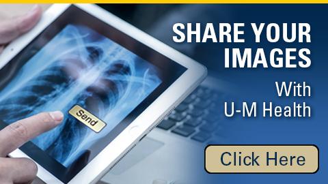 Hands holding a tablet with an X-ray displayed with a finger poised over the word "send". Text reads: Share your images with U-M Health. Click here.