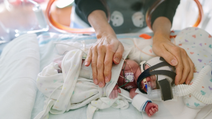 Baby on oxygen and with a heart monitor in an incubator with a nurses hands surrounding its head