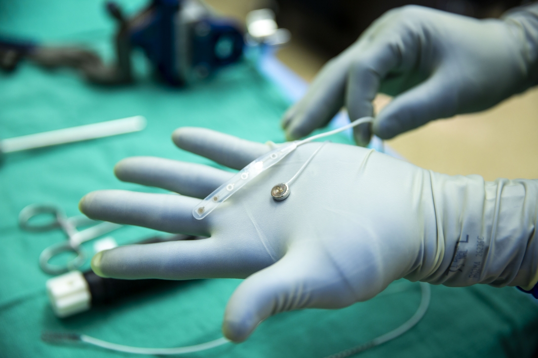 The cortical module trial, with similar dimensions to the actual implant, is compared to a typical 1x6 subdural grid.