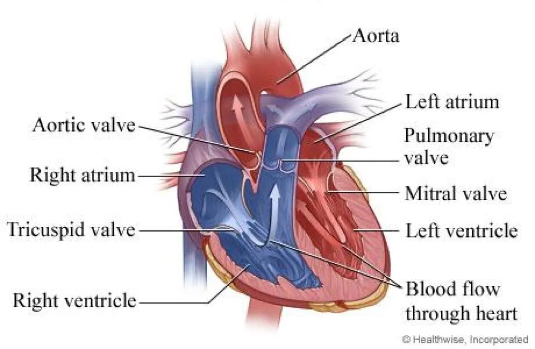diagram of normal heart with valves labeled